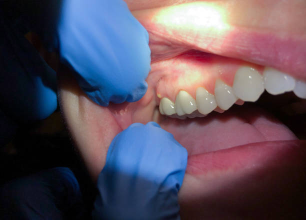 Best Cracked Tooth Emergency Dentist  in Ecru, MS